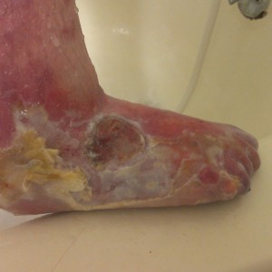 Cassie's Foot